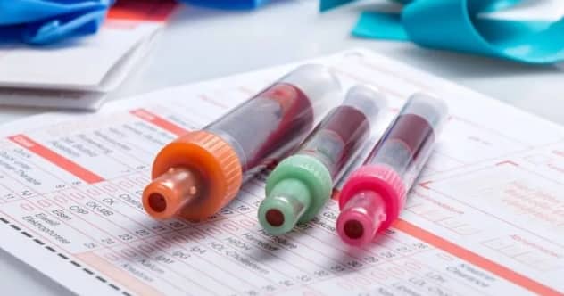 有宫腔积水做美国试管婴儿，成功率能到多少