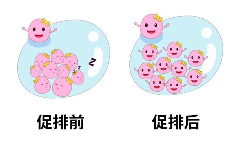 冷冻精子要花多少钱？用冷冻精子做试管成功率高吗？