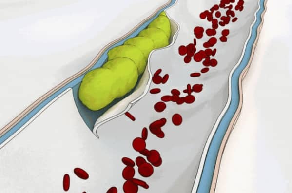 冻精是什么？和鲜精比哪个更容易怀上？