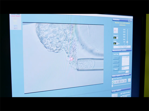 精子酸碱度与生男生女有关吗？什么是精液ph值