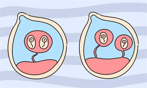 看准妈妈胸部腹部可知生男生女吗？生男生女与早餐有关吗？