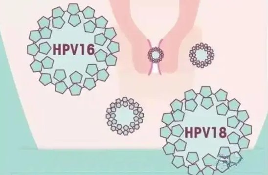 为什么普通人适合打进口二价hpv？接种二价hpv疫苗要满足什么条件