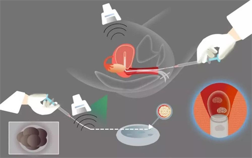 这四类夫妻最容易生女孩，排卵期生女儿的秘密!