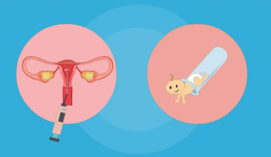 泰国能不能HIV洗精做试管婴儿？更新试管婴儿HIV洗精的过程插图1