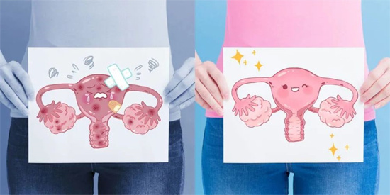 输卵管粘连会致不孕吗