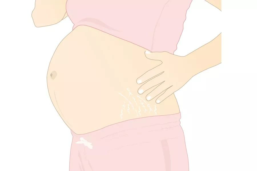 高龄高危产妇是多少岁？高危产妇能顺产吗插图1