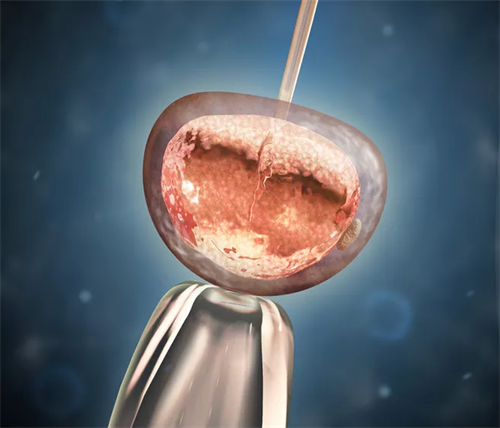 怀孕39周b超单3个数据看生男生女准吗？生男生女公式准不准？