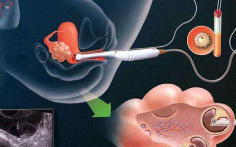 安徽哪些医院能做三代试管婴儿？