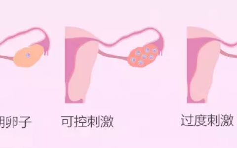 疤痕子宫做试管能怀双胞胎吗？可以放两个胚胎吗？