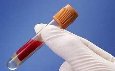 宫颈癌高发人群需警惕，这五类人尤其要注意