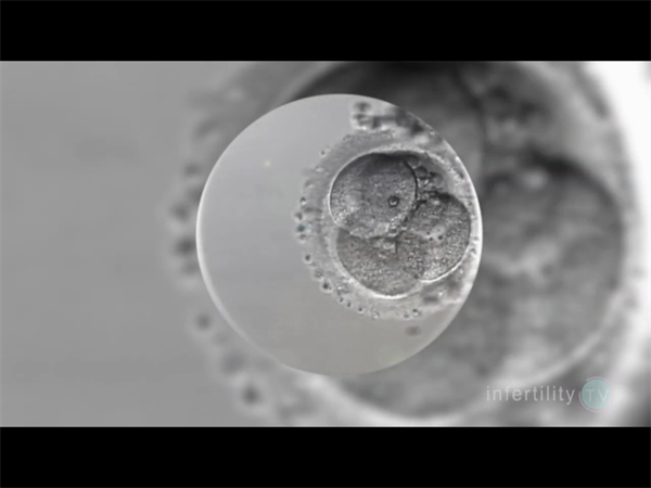 未婚女性可以去哪里做试管婴儿？2026海外单身女性试管攻略