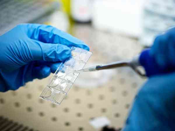 试管婴儿要花多少钱？检查费、药费、手术费明细与医保报销攻略全解